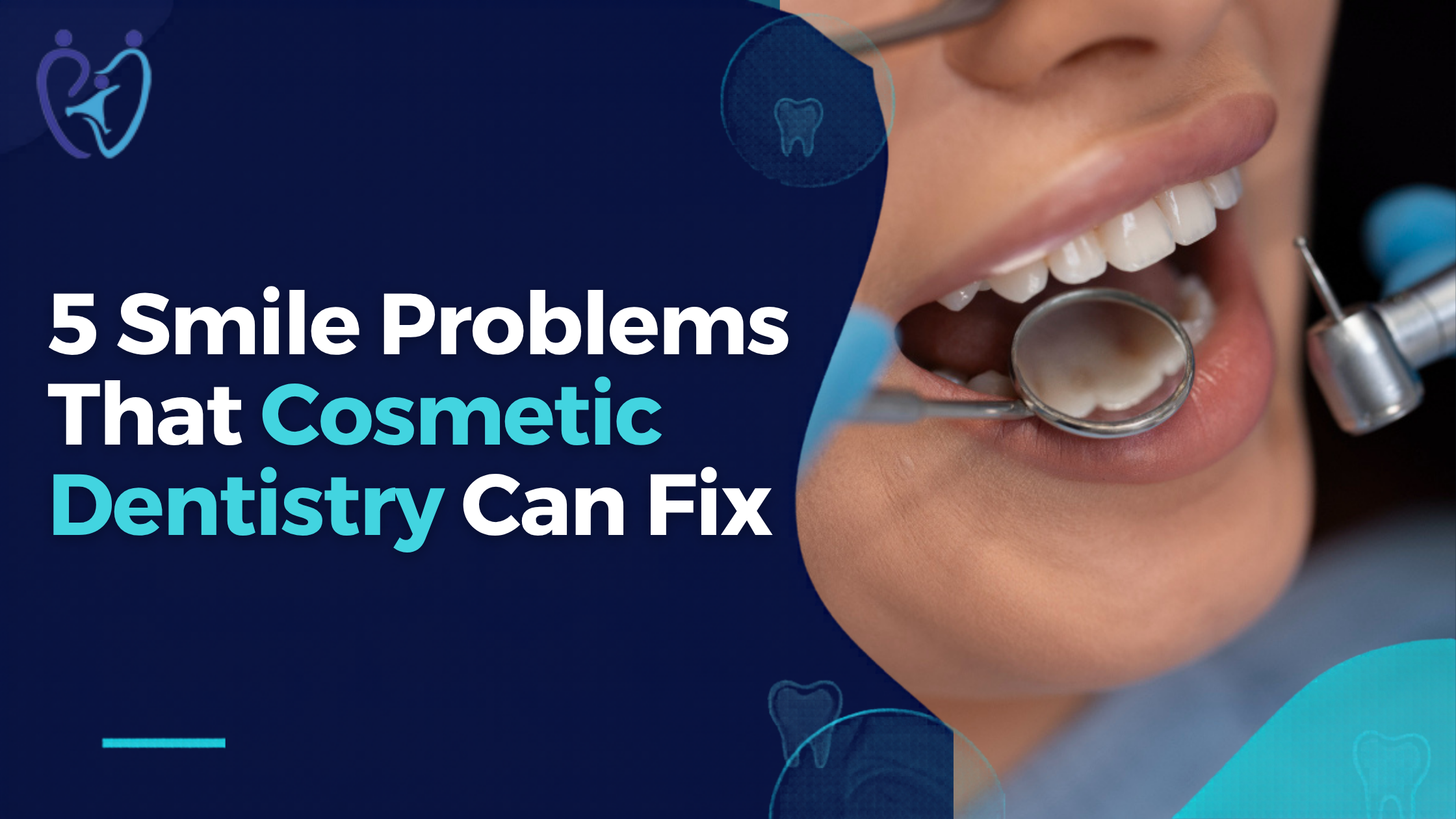 5 Smile Problems That Cosmetic Dentistry Can Fix