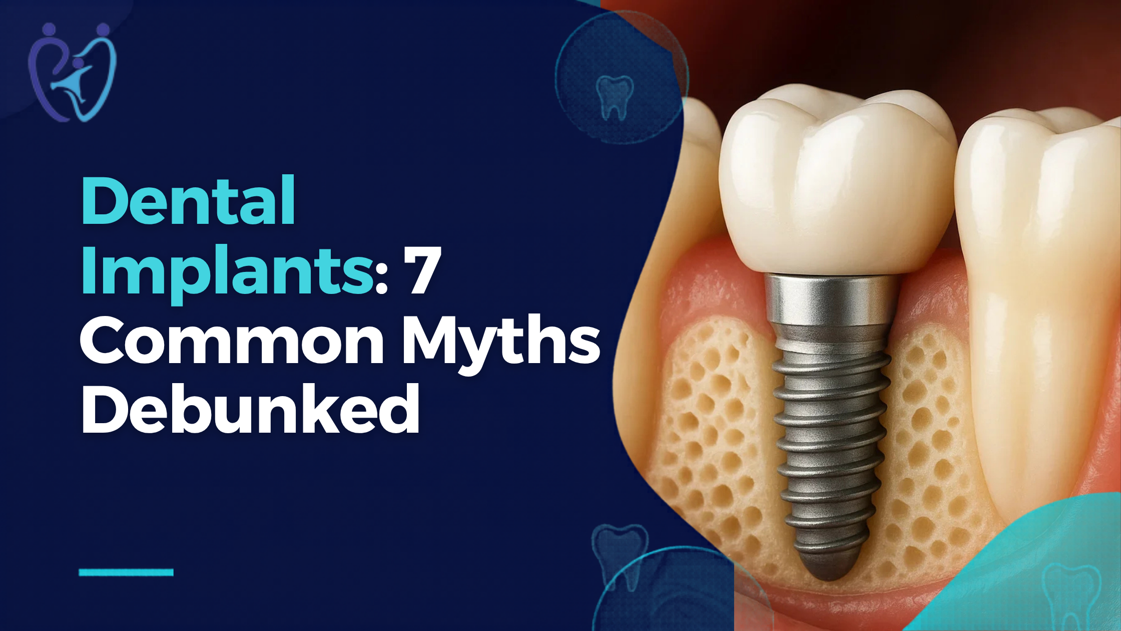 Dental Implants In Kharghar: Debunking 7 Myths Patients Ask Every Week